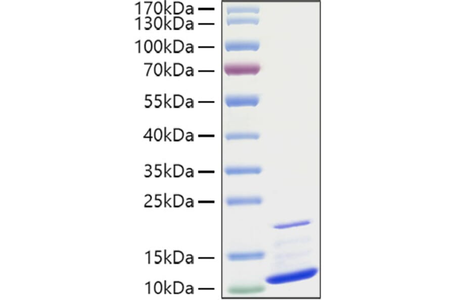 SDS-PAGE - Recombinant Human GRO gamma Protein (A330723) - Antibodies.com