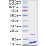 SDS-PAGE - Recombinant Human GRO gamma Protein (A330723) - Antibodies.com