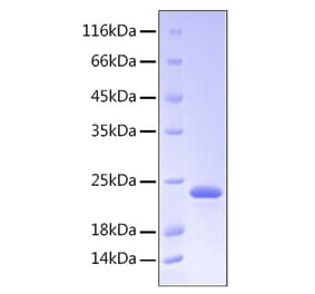 SDS-PAGE - Recombinant Human Growth Hormone Protein (C-terminal His Tag) (A330724) - Antibodies.com