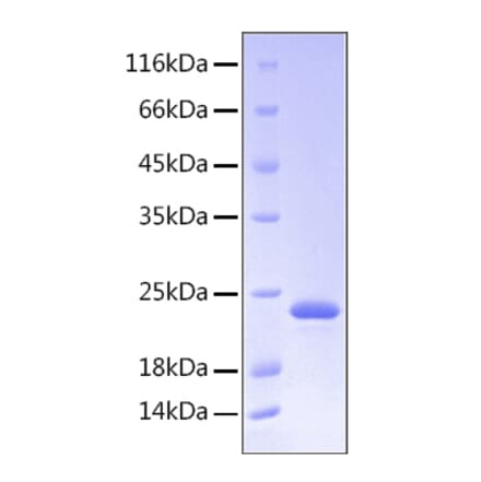 SDS-PAGE - Recombinant Human Growth Hormone Protein (C-terminal His Tag) (A330724) - Antibodies.com