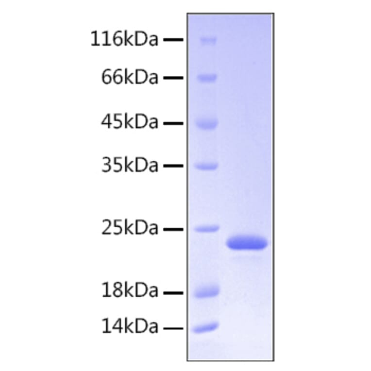 SDS-PAGE - Recombinant Human Growth Hormone Protein (C-terminal His Tag) (A330724) - Antibodies.com
