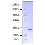 SDS-PAGE - Recombinant Human Growth Hormone Protein (C-terminal His Tag) (A330724) - Antibodies.com