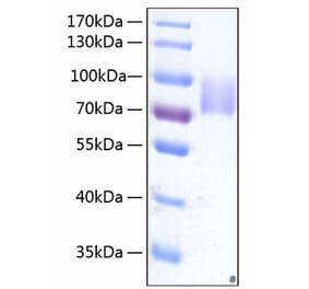 SDS-PAGE - Recombinant Human Growth hormone receptor Protein (C-terminal Human Fc and His Tag) (A330725) - Antibodies.com