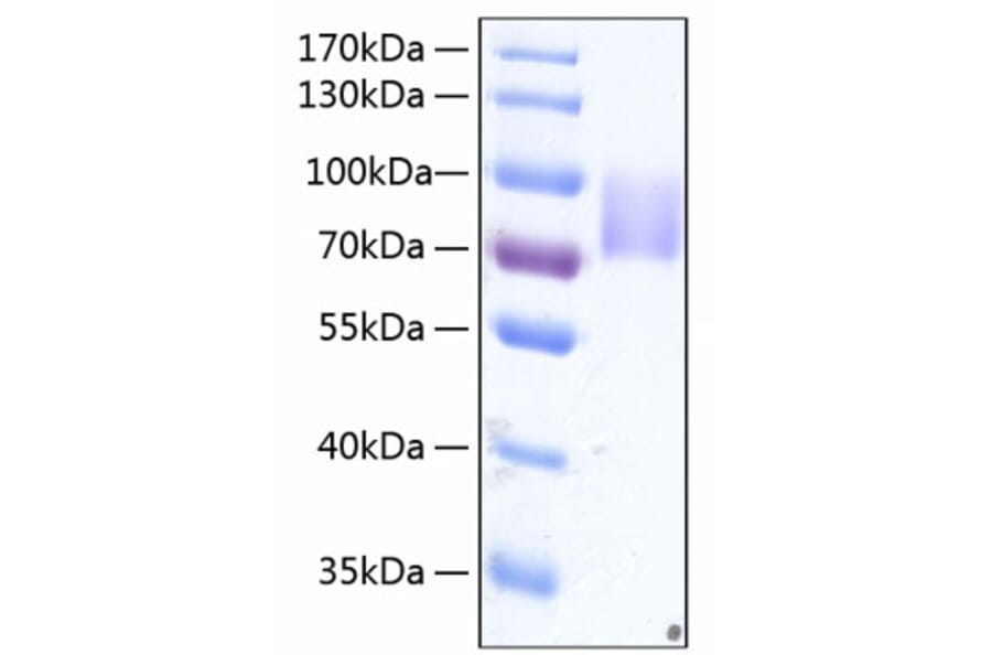 SDS-PAGE - Recombinant Human Growth hormone receptor Protein (C-terminal Human Fc and His Tag) (A330725) - Antibodies.com