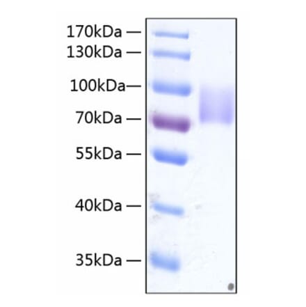 SDS-PAGE - Recombinant Human Growth hormone receptor Protein (C-terminal Human Fc and His Tag) (A330725) - Antibodies.com