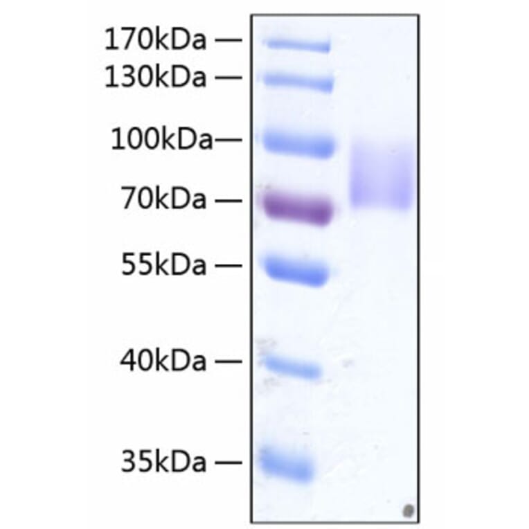 SDS-PAGE - Recombinant Human Growth hormone receptor Protein (C-terminal Human Fc and His Tag) (A330725) - Antibodies.com