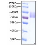 SDS-PAGE - Recombinant Human Growth hormone receptor Protein (C-terminal Human Fc and His Tag) (A330725) - Antibodies.com