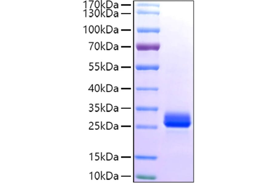 SDS-PAGE - Recombinant Human GSTA1 Protein (C-terminal His Tag) (A330726) - Antibodies.com