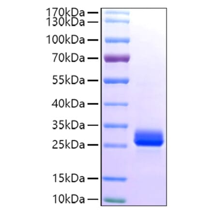 SDS-PAGE - Recombinant Human GSTA1 Protein (C-terminal His Tag) (A330726) - Antibodies.com