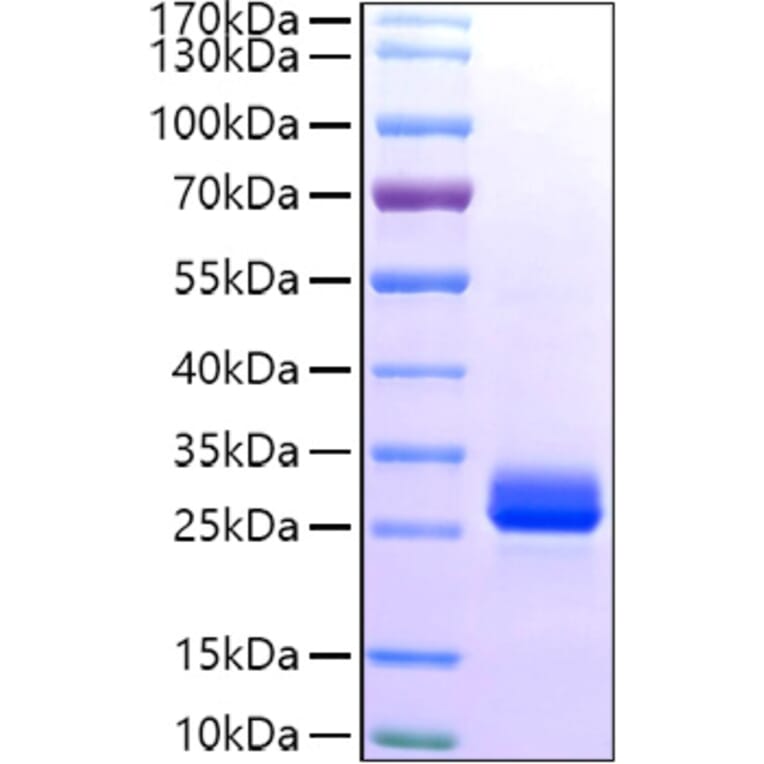 SDS-PAGE - Recombinant Human GSTA1 Protein (C-terminal His Tag) (A330726) - Antibodies.com