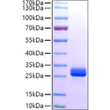 SDS-PAGE - Recombinant Human GSTA1 Protein (C-terminal His Tag) (A330726) - Antibodies.com
