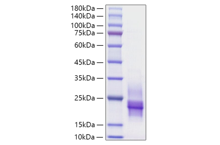 SDS-PAGE - Recombinant Human HBEGF/DTR Protein (C-terminal His Tag) (A330727) - Antibodies.com