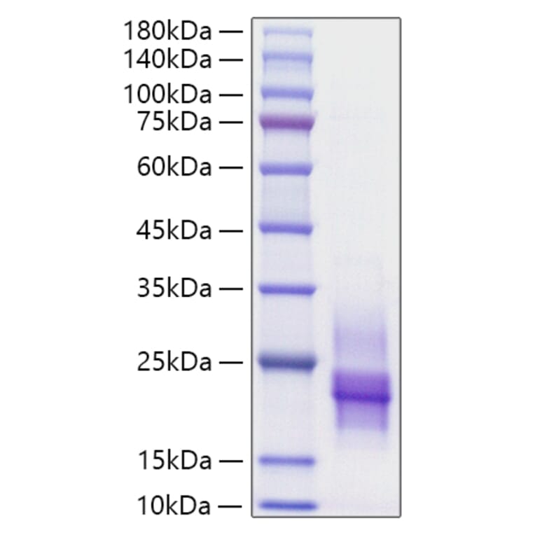 SDS-PAGE - Recombinant Human HBEGF/DTR Protein (C-terminal His Tag) (A330727) - Antibodies.com