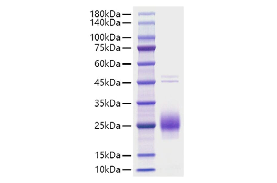 SDS-PAGE - Recombinant Human HCG alpha Protein (C-terminal His Tag) (A330728) - Antibodies.com