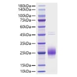 SDS-PAGE - Recombinant Human HCG alpha Protein (C-terminal His Tag) (A330728) - Antibodies.com