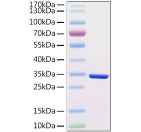 SDS-PAGE - Recombinant Human HCG beta Protein (C-terminal His Tag) (A330730) - Antibodies.com