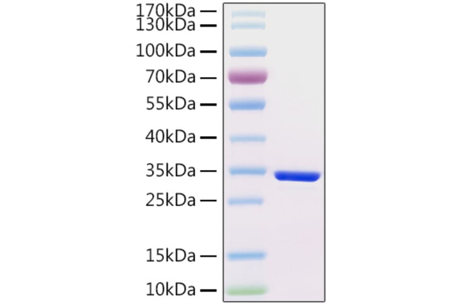 SDS-PAGE - Recombinant Human HCG beta Protein (C-terminal His Tag) (A330730) - Antibodies.com