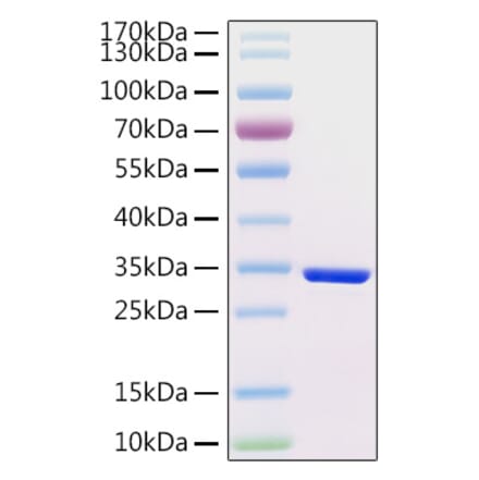 SDS-PAGE - Recombinant Human HCG beta Protein (C-terminal His Tag) (A330730) - Antibodies.com
