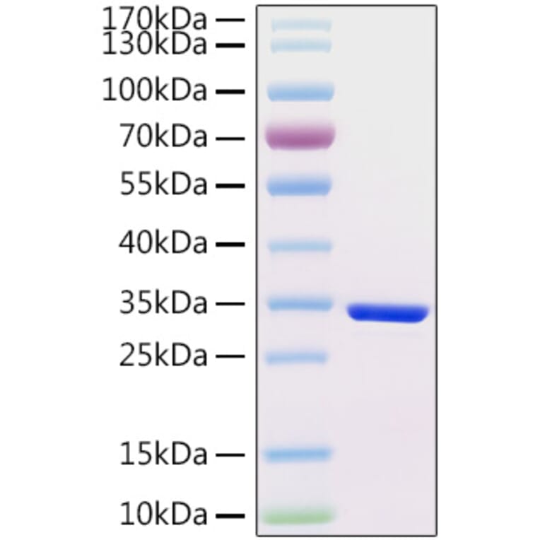 SDS-PAGE - Recombinant Human HCG beta Protein (C-terminal His Tag) (A330730) - Antibodies.com