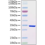SDS-PAGE - Recombinant Human HCG beta Protein (C-terminal His Tag) (A330730) - Antibodies.com