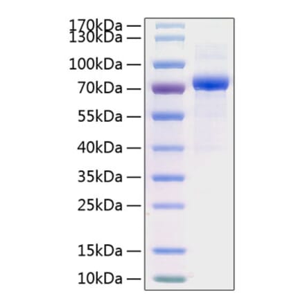 SDS-PAGE - Recombinant Human HC-II Protein (C-terminal His Tag) (A330731) - Antibodies.com