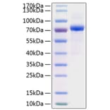 SDS-PAGE - Recombinant Human HC-II Protein (C-terminal His Tag) (A330731) - Antibodies.com