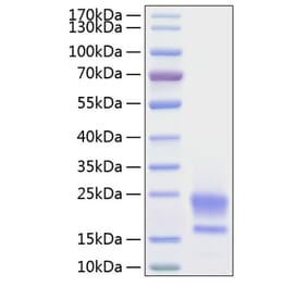 SDS-PAGE - Recombinant Human HE4 Protein (C-terminal His Tag) (A330732) - Antibodies.com