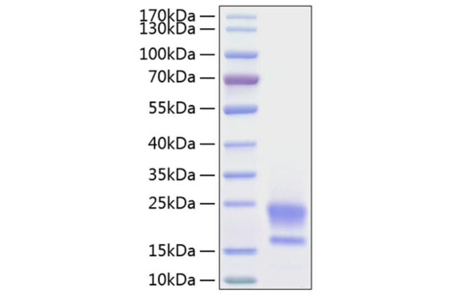 SDS-PAGE - Recombinant Human HE4 Protein (C-terminal His Tag) (A330732) - Antibodies.com