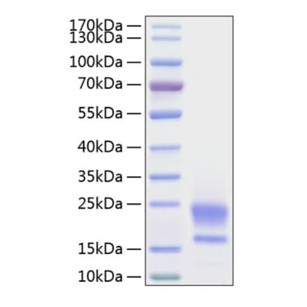 SDS-PAGE - Recombinant Human HE4 Protein (C-terminal His Tag) (A330732) - Antibodies.com