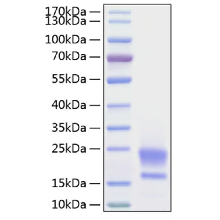 SDS-PAGE - Recombinant Human HE4 Protein (C-terminal His Tag) (A330732) - Antibodies.com