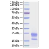 SDS-PAGE - Recombinant Human HE4 Protein (C-terminal His Tag) (A330732) - Antibodies.com