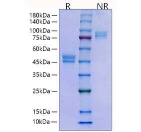 SDS-PAGE - Recombinant Human HE4 Protein (C-terminal Human Fc Tag) (A330733) - Antibodies.com