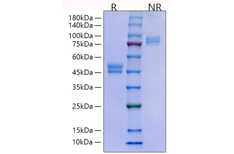 SDS-PAGE - Recombinant Human HE4 Protein (C-terminal Human Fc Tag) (A330733) - Antibodies.com