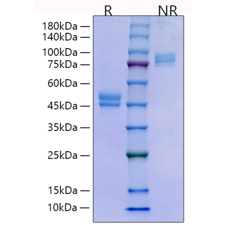 SDS-PAGE - Recombinant Human HE4 Protein (C-terminal Human Fc Tag) (A330733) - Antibodies.com