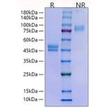 SDS-PAGE - Recombinant Human HE4 Protein (C-terminal Human Fc Tag) (A330733) - Antibodies.com