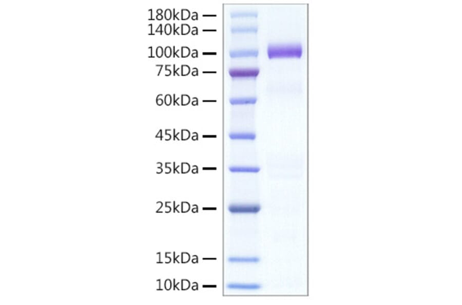 SDS-PAGE - Recombinant Human HGF Protein (C-terminal His Tag) (A330734) - Antibodies.com