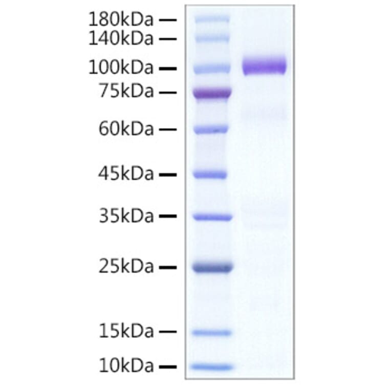 SDS-PAGE - Recombinant Human HGF Protein (C-terminal His Tag) (A330734) - Antibodies.com