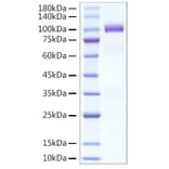 SDS-PAGE - Recombinant Human HGF Protein (C-terminal His Tag) (A330734) - Antibodies.com
