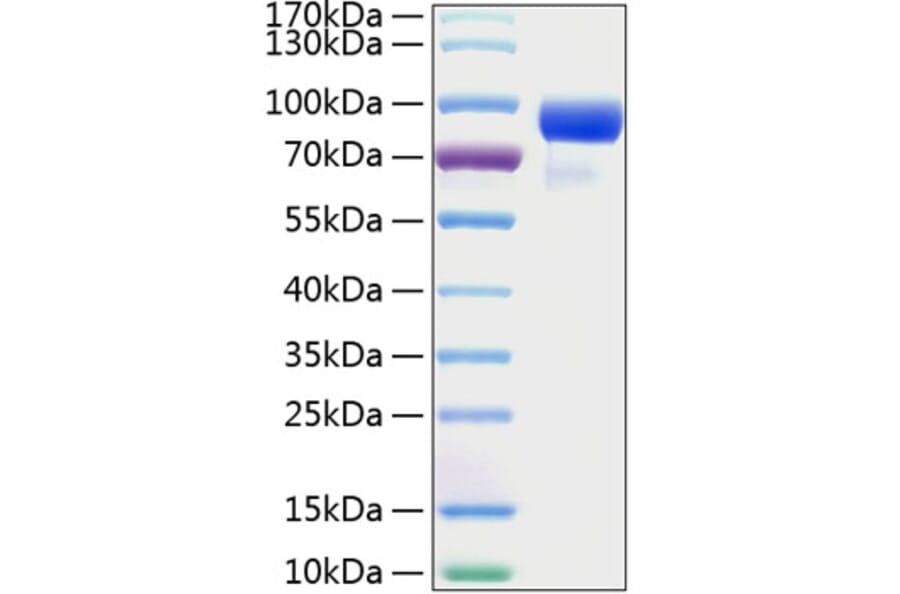SDS-PAGE - Recombinant Human HHIP Protein (C-terminal His Tag) (A330735) - Antibodies.com