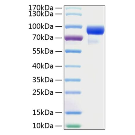 SDS-PAGE - Recombinant Human HHIP Protein (C-terminal His Tag) (A330735) - Antibodies.com
