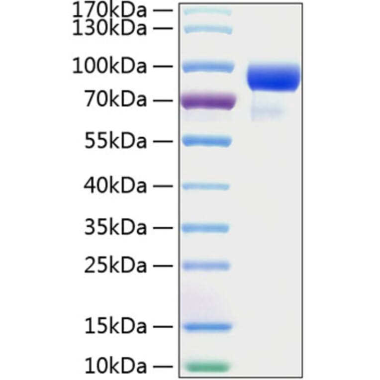 SDS-PAGE - Recombinant Human HHIP Protein (C-terminal His Tag) (A330735) - Antibodies.com