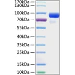 SDS-PAGE - Recombinant Human HHIP Protein (C-terminal His Tag) (A330735) - Antibodies.com