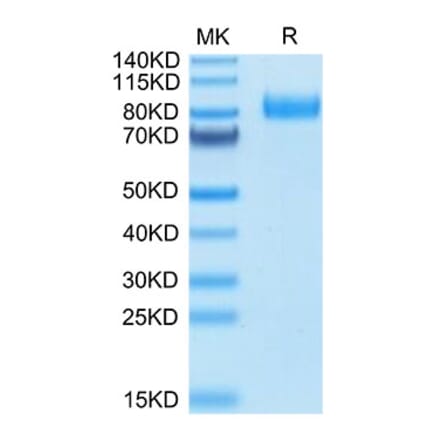 Tris-Bis PAGE - Recombinant Human HHLA2 Protein (C-terminal Human Fc Tag) (A330736) - Antibodies.com