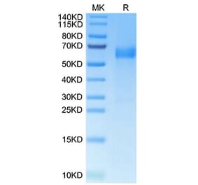 Tris-Bis PAGE - Recombinant Human HHLA2 Protein (C-terminal His Tag) (A330737) - Antibodies.com
