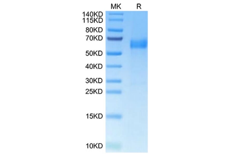 Tris-Bis PAGE - Recombinant Human HHLA2 Protein (C-terminal His Tag) (A330737) - Antibodies.com