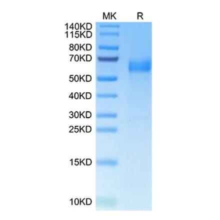 Tris-Bis PAGE - Recombinant Human HHLA2 Protein (C-terminal His Tag) (A330737) - Antibodies.com