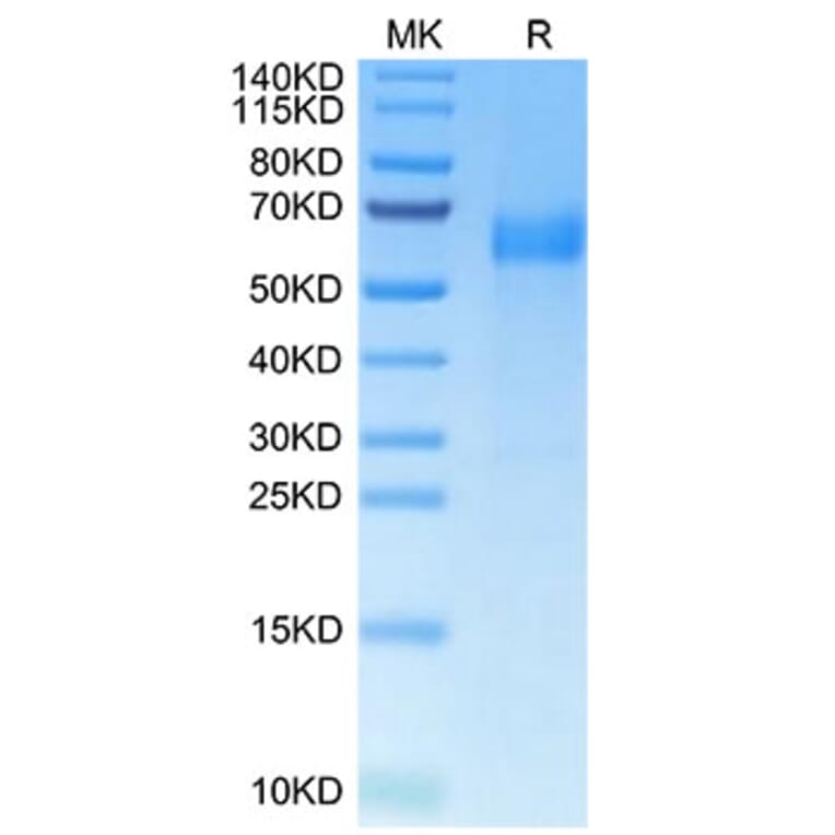 Tris-Bis PAGE - Recombinant Human HHLA2 Protein (C-terminal His Tag) (A330737) - Antibodies.com