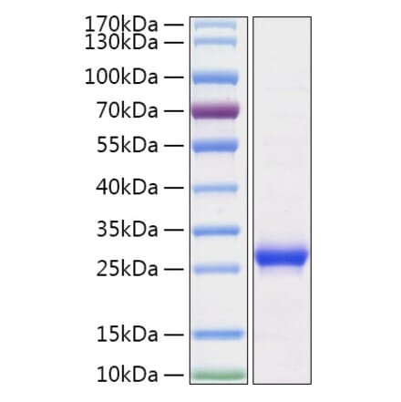SDS-PAGE - Recombinant Human Histone H1 Protein (N-terminal His Tag) (A330739) - Antibodies.com