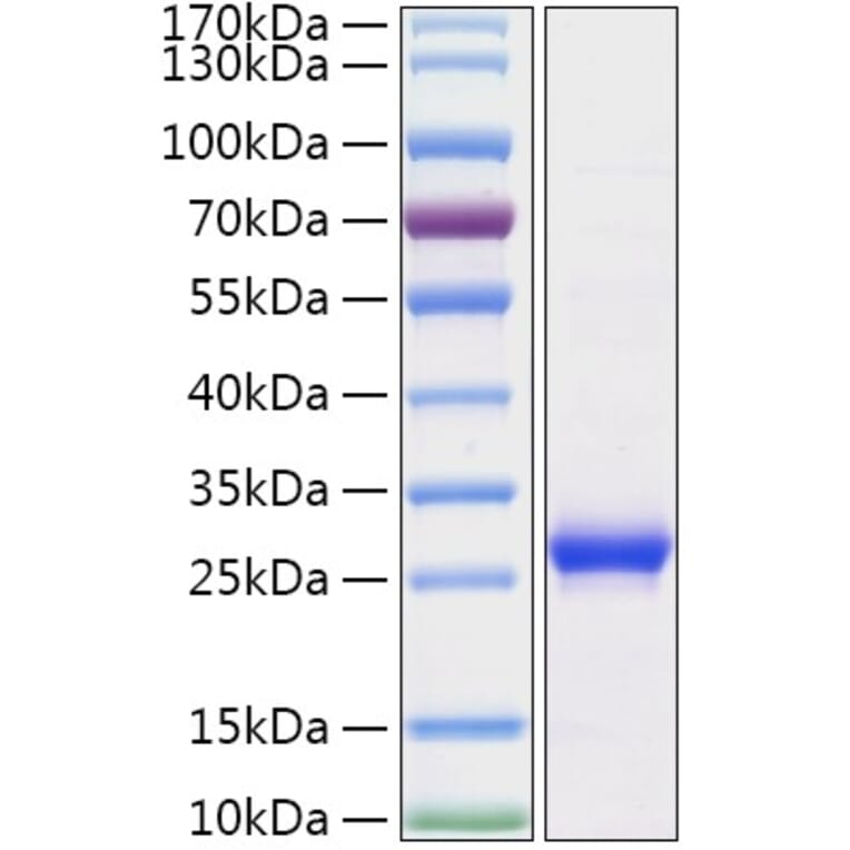 SDS-PAGE - Recombinant Human Histone H1 Protein (N-terminal His Tag) (A330739) - Antibodies.com