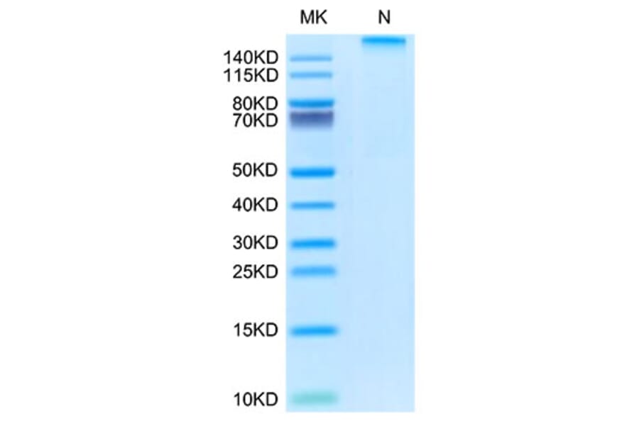 Tris-Bis PAGE - Recombinant Rhesus macaque HLA-G Protein (C-terminal His and Avi Tag) (A330741) - Antibodies.com
